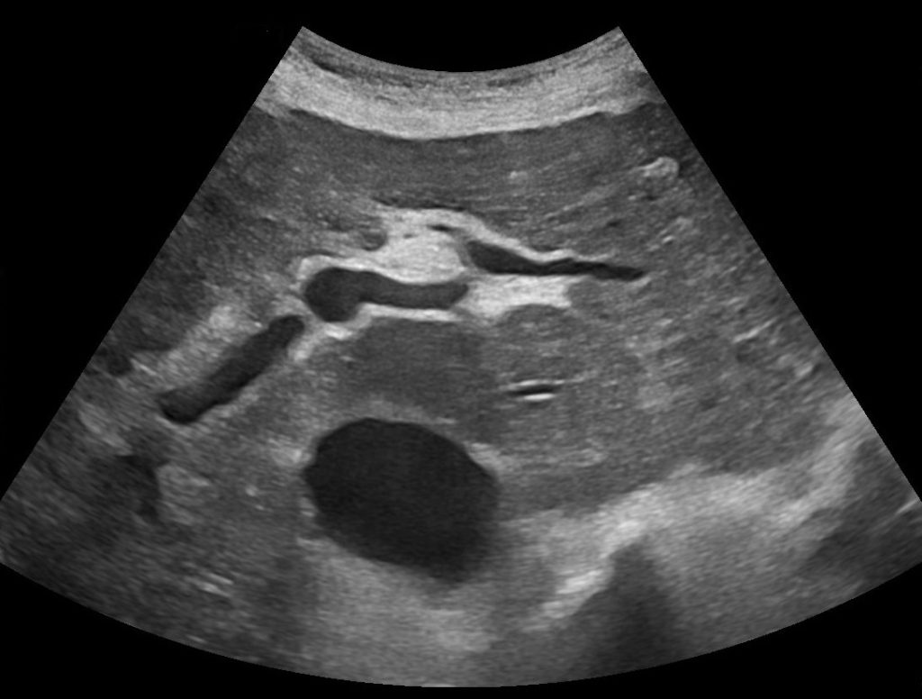 SECHO QUIZ • CASE 1